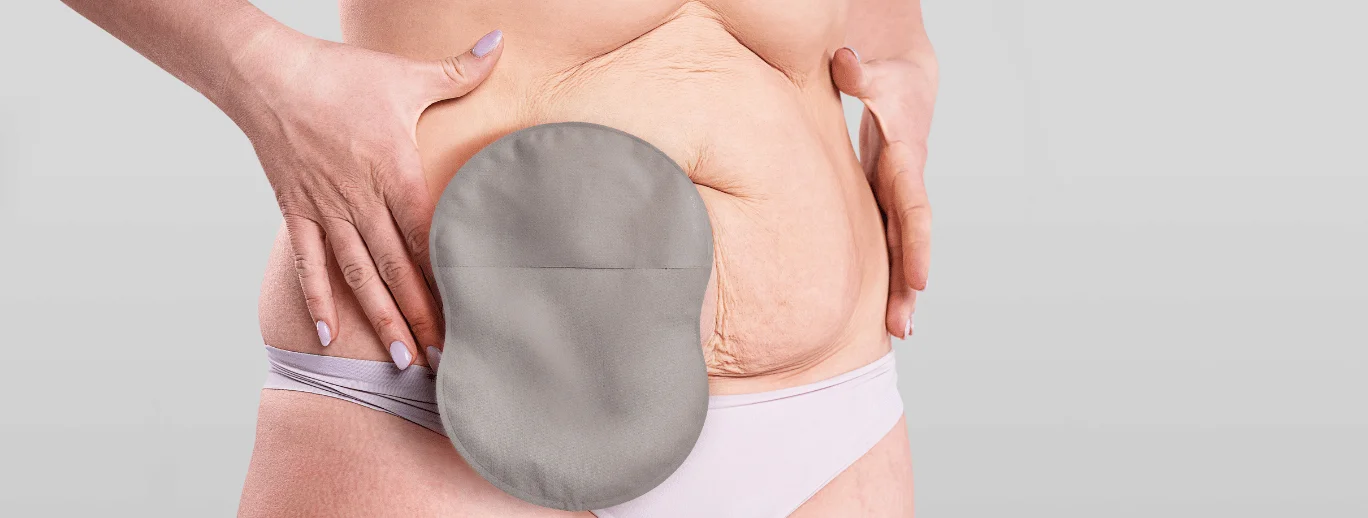 Stoma bag on person